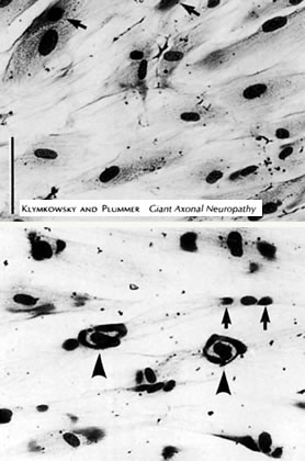 GAN serum effect